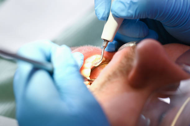 Best Pediatric Emergency Dentist in Concordia, KS
