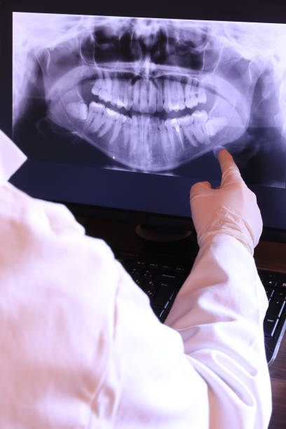 Best Emergency Root Canal Treatment in Concordia, KS