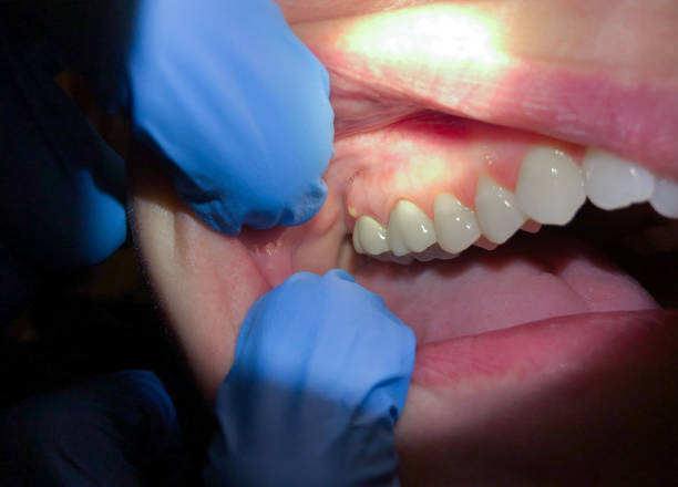 Best Emergency Dental Care for Trauma or Injury in Concordia, KS
