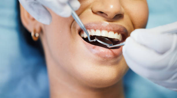 Best Emergency Treatment for Toothache in Concordia, KS
