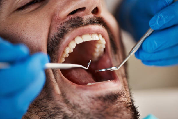 Best Emergency Tooth Extraction in Concordia, KS