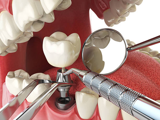 Fast & Reliable Emergency Dental Services in KS