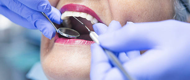 Best Emergency Tooth Extraction in Concordia, KS